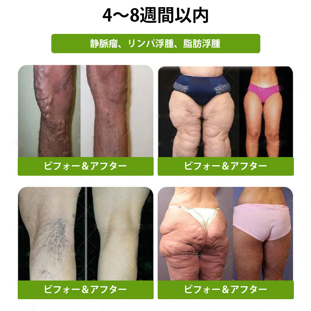 GeeBeon® Glumasetide 8-in-1 スリム＆ヘルシー・ナノマイクロニードルパッチ（1日1回使用 — 最短7日で変化を実感） ✅ 肥満、肌の引き締め、糖尿病、睡眠時無呼吸症候群、関節の悩みなどに。-🎯