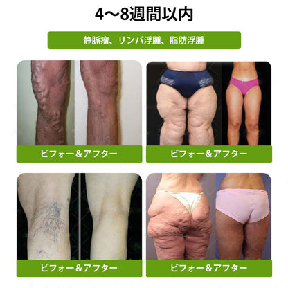 GeeBeon® Glumasetide 8-in-1 スリム＆ヘルシー・ナノマイクロニードルパッチ（1日1回使用 — 最短7日で変化を実感） ✅ 肥満、肌の引き締め、糖尿病、睡眠時無呼吸症候群、関節の悩みなどに。-🎯